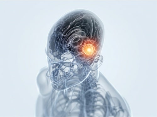 Tratamento de ependimoma e meduloblastoma
